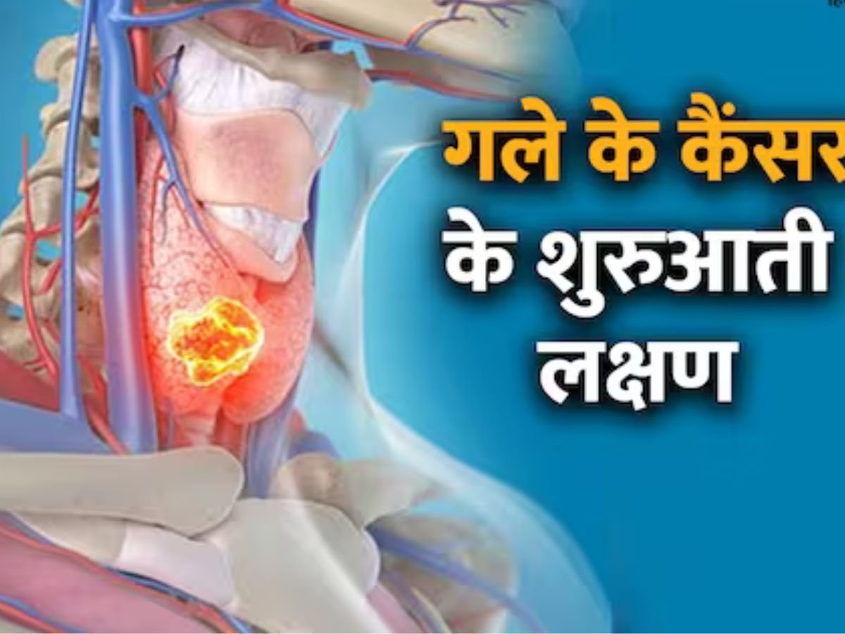 Throat Cancer Symptoms