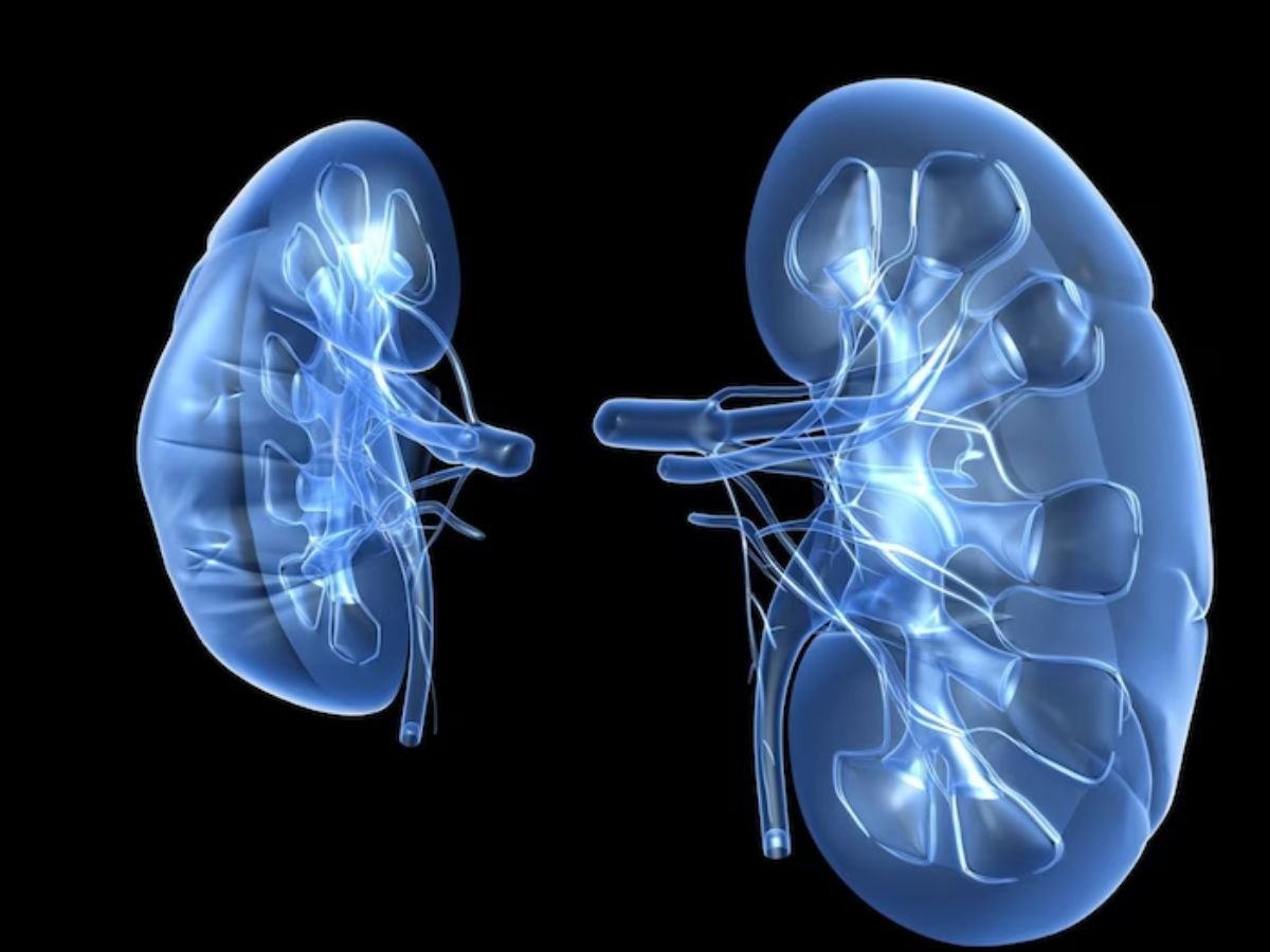 किडनी (1)