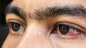 download - 2024-03-26T174455.137