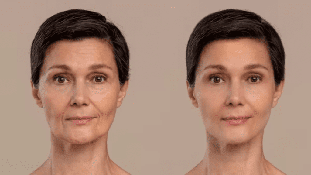 हमेशा युवा दिखने के लिए अपनाएँ ये 7 सरल सूत्र 1 image 498