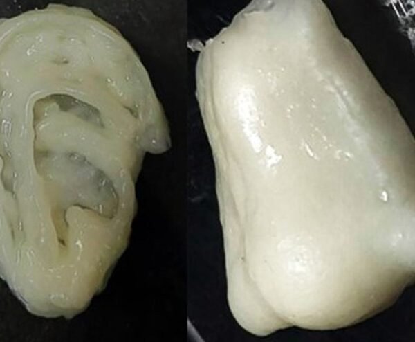 भविष्य की क्रांति: 3D Printing Bone Cartilage से जुड़ेंगी टूटी हड्डियां और ठीक होगा कार्टिलेज