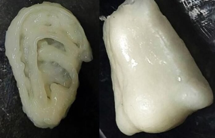 भविष्य की क्रांति: 3D Printing Bone Cartilage से जुड़ेंगी टूटी हड्डियां और ठीक होगा कार्टिलेज